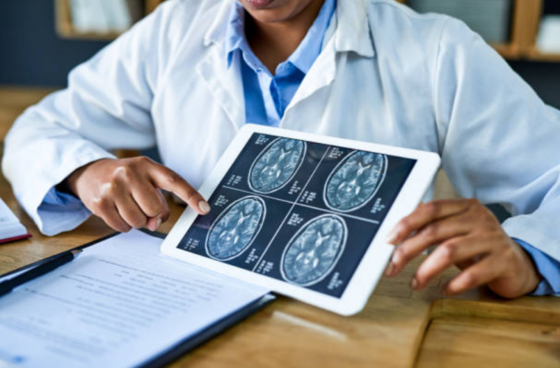 Living Well: Managing Chronic Neurological Disorders with Expert Care